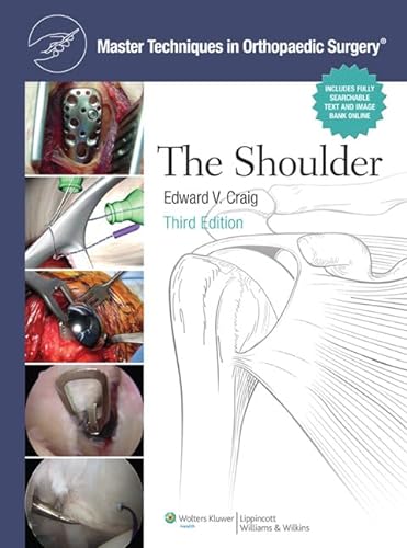 The Shoulder (Master Techniques in Orthopaedic Surgery) von LWW